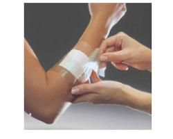 FILM ADESIVO IN POLIURETANO OPSITE FLEXIFIX IN ROTOLO TRASPARENTE IMPERMEABILE PER FISSAGGIO DI MEDICAZIONI E CATETERI LARGHEZZA 15 CM LUNGHEZZA 10 M 1 PEZZO - Gruppofarmastore.it