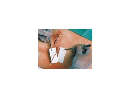 MEDICAZIONE PER TUBI DI DRENAGGIO FESSURATA METALLINE DRAIN 6X7CM FORO 4,5X11MM 50 PEZZI - Gruppofarmastore.it